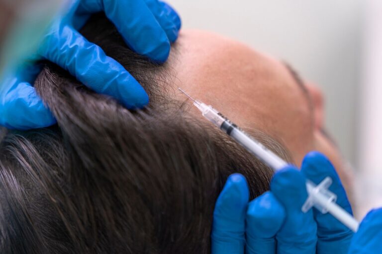 GFC Treatment Cost