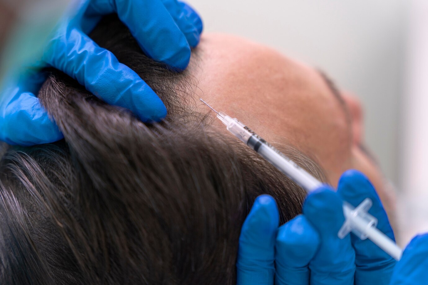 GFC Treatment Cost