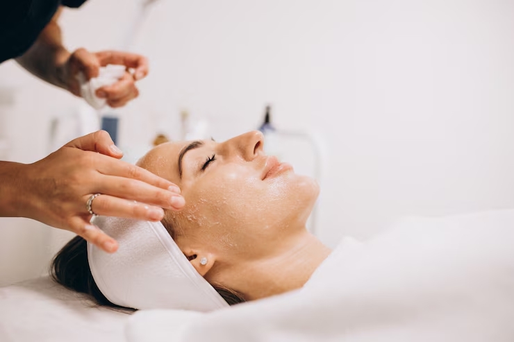 Chemical Peel