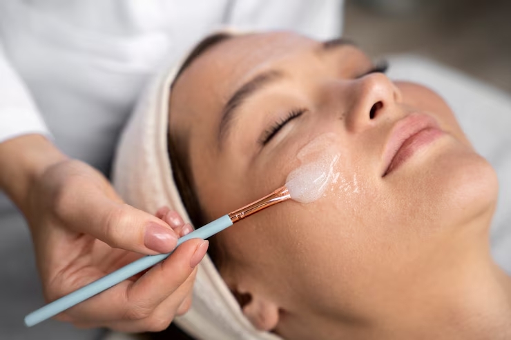 Does Your Skin Glow After a Chemical Peel?